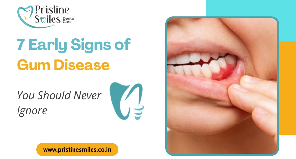 7 Early Signs of Gum Disease You Should Never Ignore