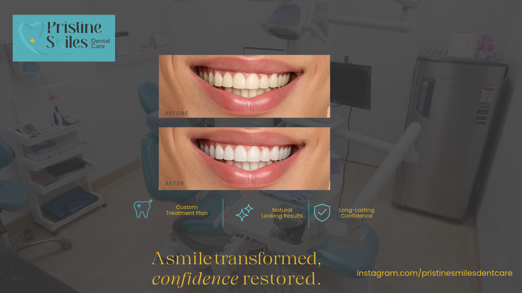 professional dental cleaning