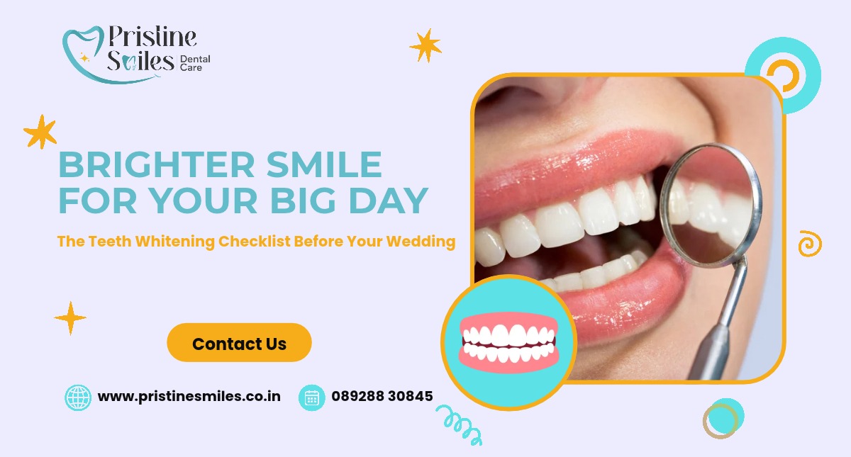 teeth whitening