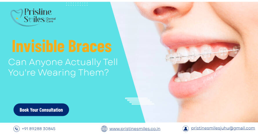 Invisible Braces