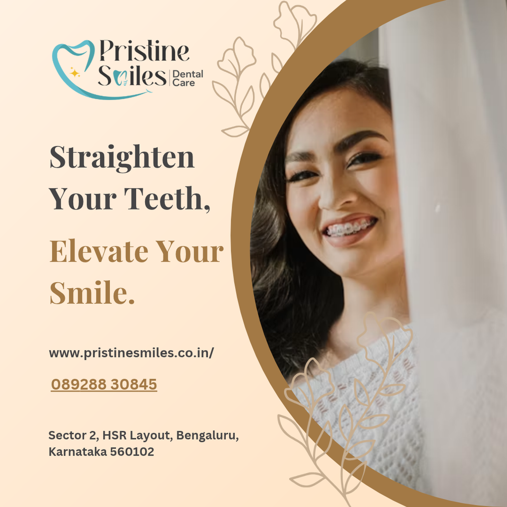 Invisible Braces