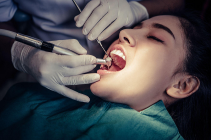 Root Canal Treatment